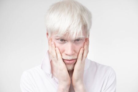 portrait of an albino man in  studio dressed t-shirt isolated on a white background. abnormal...