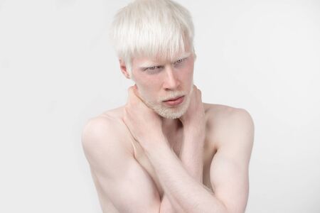 portrait of an albino man in  studio dressed t-shirt isolated on a white background. abnormal deviations. unusual appearance. skin abnormalityの写真素材