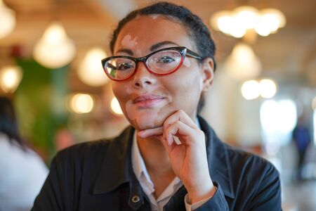 A beautiful young girl of African ethnicity with vitiligo sitting in a restaurant close up portrait of woman with skin problems.の写真素材