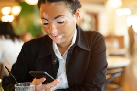 A beautiful young girl of African ethnicity with vitiligo sitting in a restaurant close up portrait of woman with skin problems.の写真素材