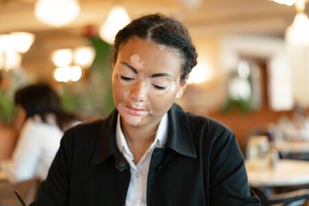 A beautiful young girl of African ethnicity with vitiligo sitting in a restaurant close up portrait of woman with skin problems.の写真素材