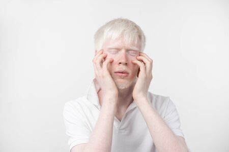 portrait of an albino man in  studio dressed t-shirt isolated on a white background. abnormal deviations. unusual appearance. skin abnormalityの写真素材
