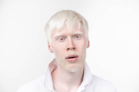 portrait of an albino man in  studio dressed t-shirt isolated on a white background. abnormal deviations. unusual appearance. skin abnormalityの写真素材