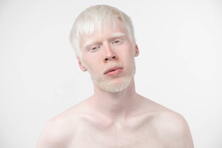 portrait of an albino man in  studio dressed t-shirt isolated on a white background. abnormal deviations. unusual appearance. skin abnormalityの写真素材