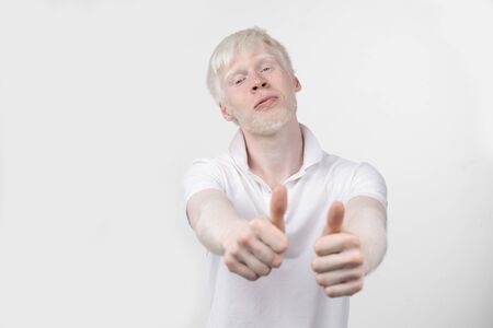 portrait of an albino man in  studio dressed t-shirt isolated on a white background. abnormal deviations. unusual appearance. skin abnormalityの写真素材