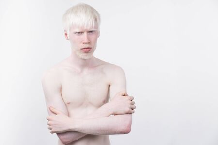 portrait of an albino man in  studio dressed t-shirt isolated on a white background. abnormal deviations. unusual appearance. skin abnormalityの写真素材