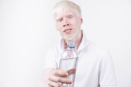 portrait of an albino man in  studio dressed t-shirt isolated on a white background. abnormal deviations. unusual appearance. skin abnormalityの写真素材