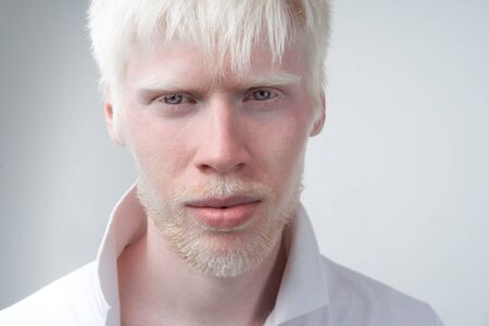 Sad albino man white skin hair studio dressed t-shirt isolated white background. abnormal deviations. unusual appearance. skin abnormality Beautiful people with  special appearance. の写真素材