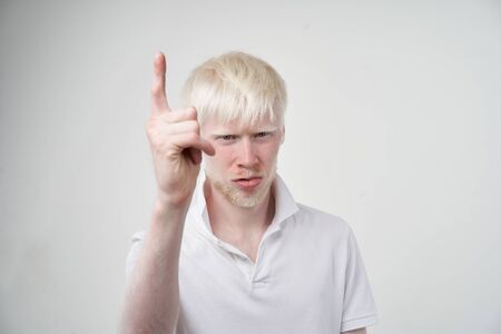Sad albino man white skin hair studio dressed t-shirt isolated white background. abnormal deviations. unusual appearance. skin abnormality Beautiful people with  special appearance. の写真素材
