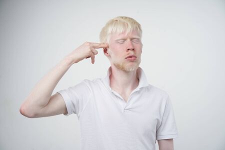 Sad albino man white skin hair studio dressed t-shirt isolated white background. abnormal deviations. unusual appearance. skin abnormality Beautiful people with  special appearance. の写真素材