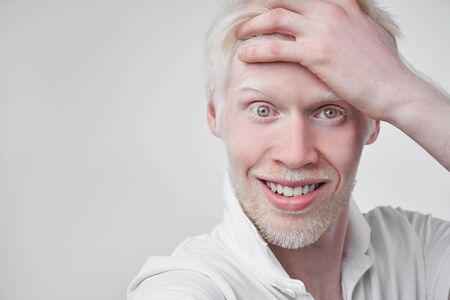 Happy smiling albino man white skin hair studio dressed t-shirt isolated white background abnormal deviations unusual appearance abnormality Beautiful people  の写真素材