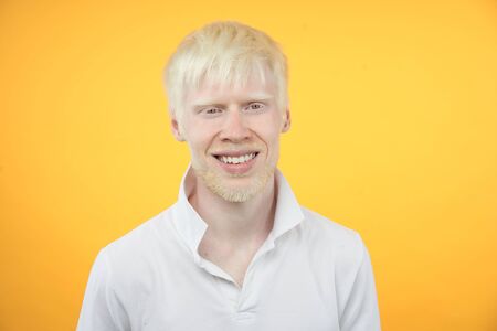 Happy smiling albino man white skin hair studio dressed t-shirt isolated yellow background abnormal deviations unusual appearance abnormality Beautiful people  の写真素材