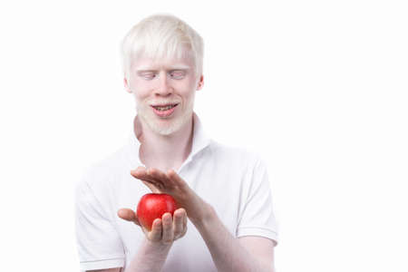 albinism albino man white skin hair studio dressed t-shirt isolated white background. abnormal deviations. unusual appearance. skin abnormality Beautiful people with special appearance. Eat red appleの写真素材
