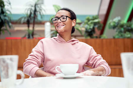 Black african american woman with vitiligo pigmentation skin problem indoor dressed pink hoodie...