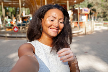 Happy woman with vitiligo pigmentation skin problem taking selfie in city park. Smiling African American lady with eyes closed is spending leisure time outdoors during weekend.の写真素材