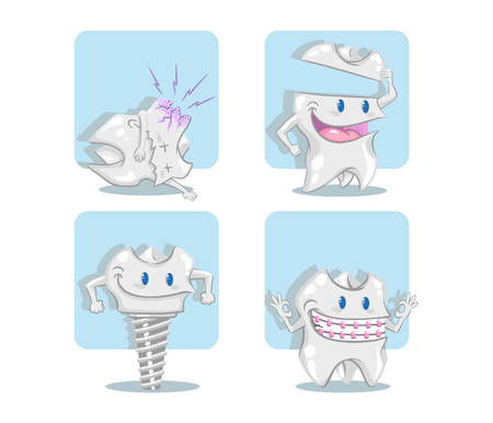 Set of different teeth, teeth with  decay, tooth implant in blue background.のイラスト素材