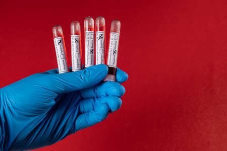 Test tube with blood sample for COVID-19 test