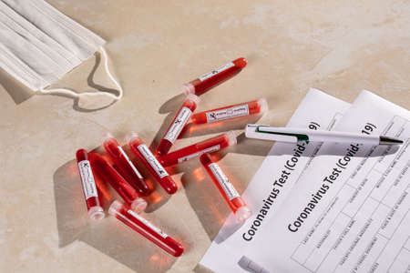 Test tube with blood sample for COVID-19 test