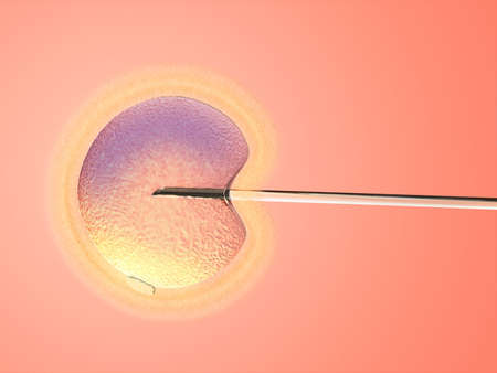 Artificial insemination. Glass needle and female ovule on wam background. Digital illustration.の写真素材