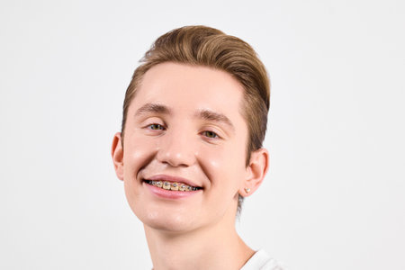 A young man with braces on his teeth is smiling directly at the camera.
