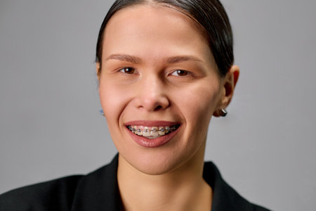 Bright attractive young woman with braces smiling with mouth wide open.の写真素材