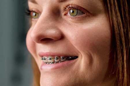 Close-up of teeth with braces.の写真素材