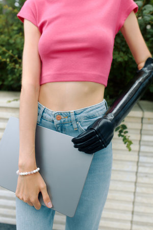 A woman with a bionic prosthesis holds a laptop while standing outside.