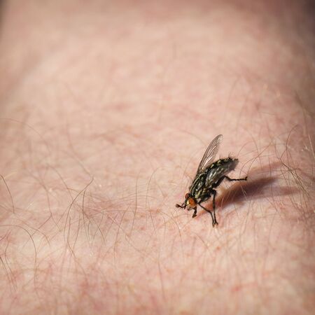 The insect bites a man in the leg, close-up.の写真素材