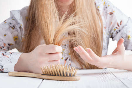 Woman with hair problems,lost hair on combの写真素材