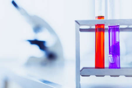 Close-up of colorful chemical test tubes on tray in medical laboratory