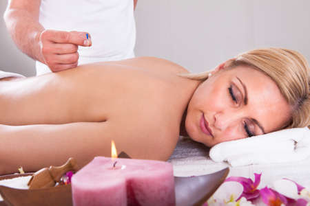 Young Beautiful Woman In An Acupuncture Therapy In A Spa Centerの写真素材