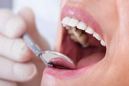 Close-up Of Female Patient Examined By Dentistの写真素材