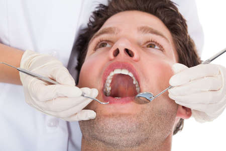 Close-up Of A Dentist Examining Patient's Teethの写真素材