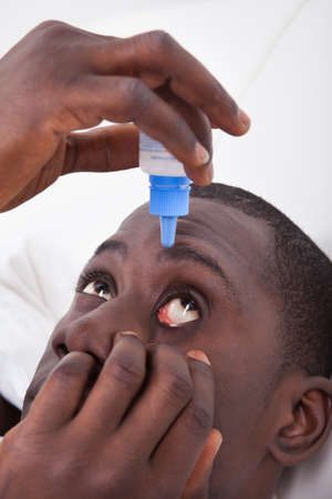 Close-up Of African Man Applying Eye Drop