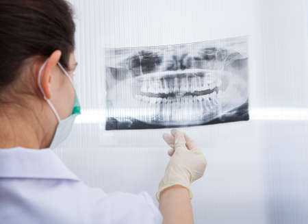 Rear view of female dentist looking at dental Xray in clinicの写真素材
