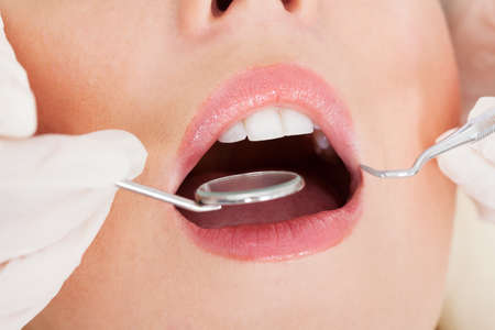 Close-up Of A Woman Having Her Dental Checkup