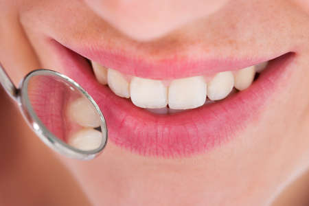 Closeup of young woman having her dental checkupの写真素材