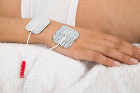 Close-up Of A Woman With Electrodes On Her Handの写真素材