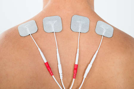 Close-up Of Man With Electrostimulator Electrodes On His Backの写真素材