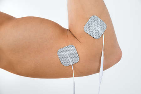 Close-up Of Person Biceps With Electrostimulator Electrodes