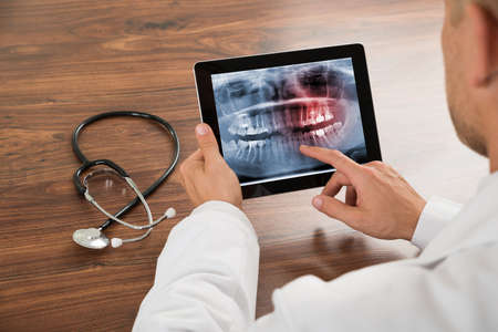 Close-up Of Doctor Looking At Human Teeth X-ray On The Digital Tabletの写真素材