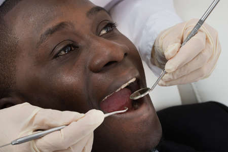 Close-up Of Doctor Hands Doing Dental Check Up Of Male African Patientの写真素材