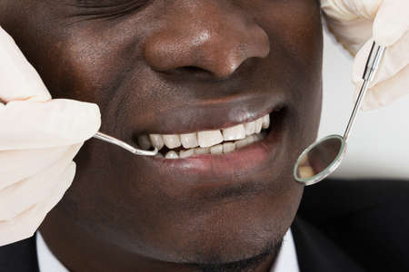 Close-up Of Doctor Hands Doing Dental Check Up Of Male African Patientの写真素材
