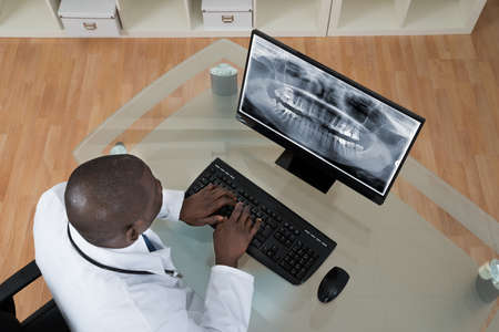 Young African Dentist Analyzing X-ray Teeth On Screen Of Computer At Deskの写真素材
