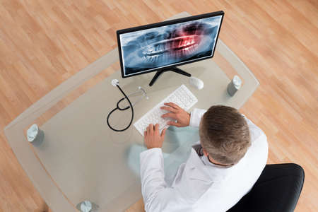 Young Doctor Examining Teeth X-ray On Computer At Deskの写真素材