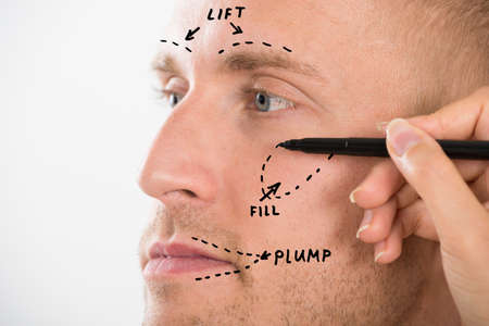 Close-up Of A Man's Face With Correction Line Drawn By Person's Hand For Plastic Surgeryの写真素材