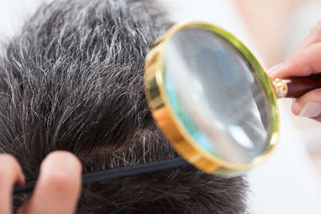 Close Up Of Dermatologist Checking Patient's Hair Through Magnifying Glass