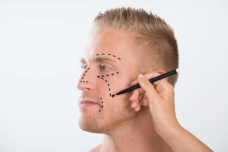 Close-up Of Person's Hand Drawing Correction Line With Pen Near Man's Eyesの写真素材