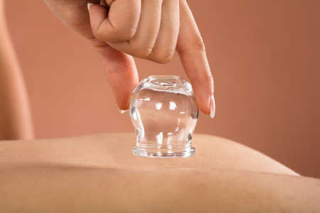 Close-up Of A Therapist Hand Giving Cupping Treatment In Spa