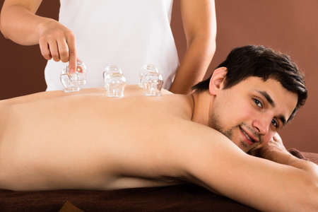 Relaxed Young Man Receiving Cupping Treatment On Back In Spaの写真素材